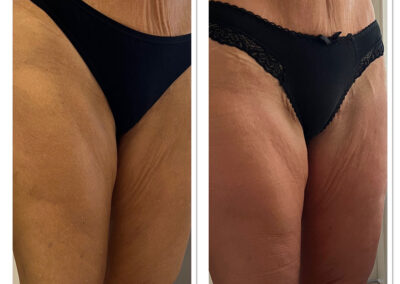 Wiener fásli, elysion munkák External