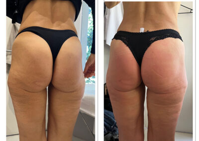 Wiener fásli, elysion munkák External