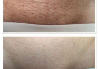 Wiener fásli, elysion munkák External