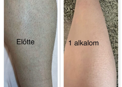 Wiener fásli, elysion munkák External